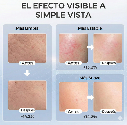 Máscara Facial LED Pro + Mando de Control GRATIS